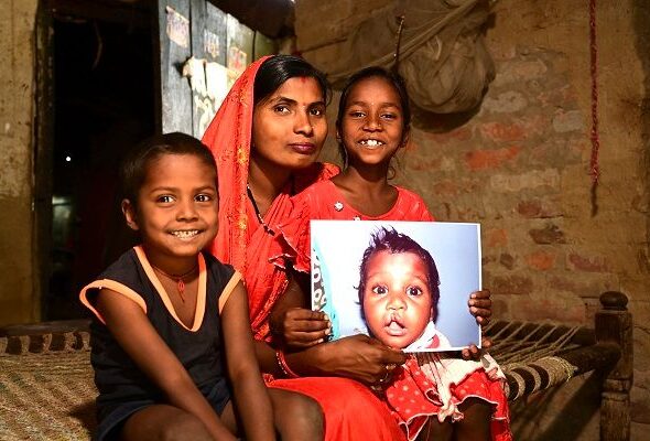World Cleft Awareness Day, Smile Train India Marks 800,000+ Free Surgeries